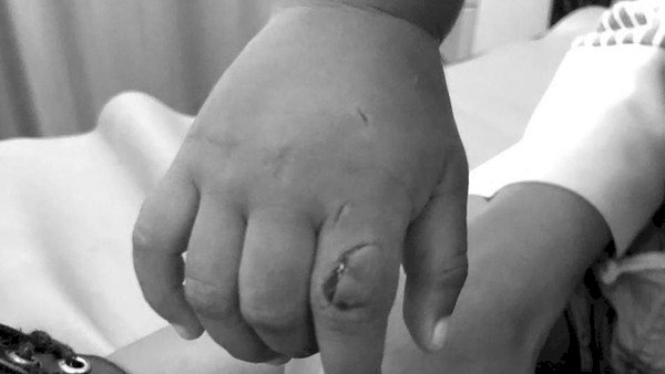 Ikan Aligator di Lapas Wanita Bandung Gigit Balita