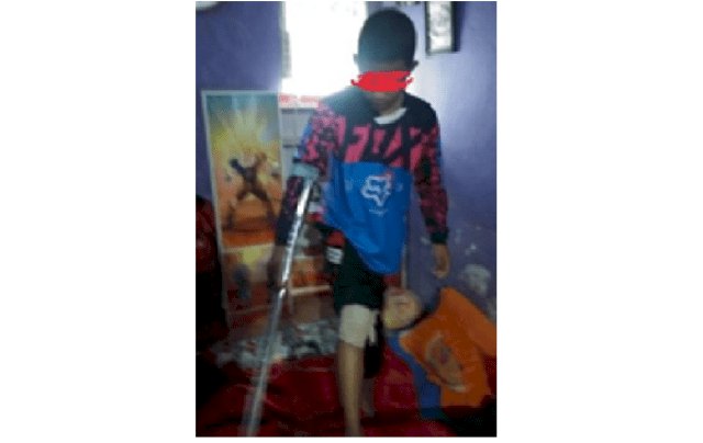 Tak Ikut Yasinan Oknum Guru Kerinci Diduga Tendang Siswa Hingga Tulang Kakinya Lepas